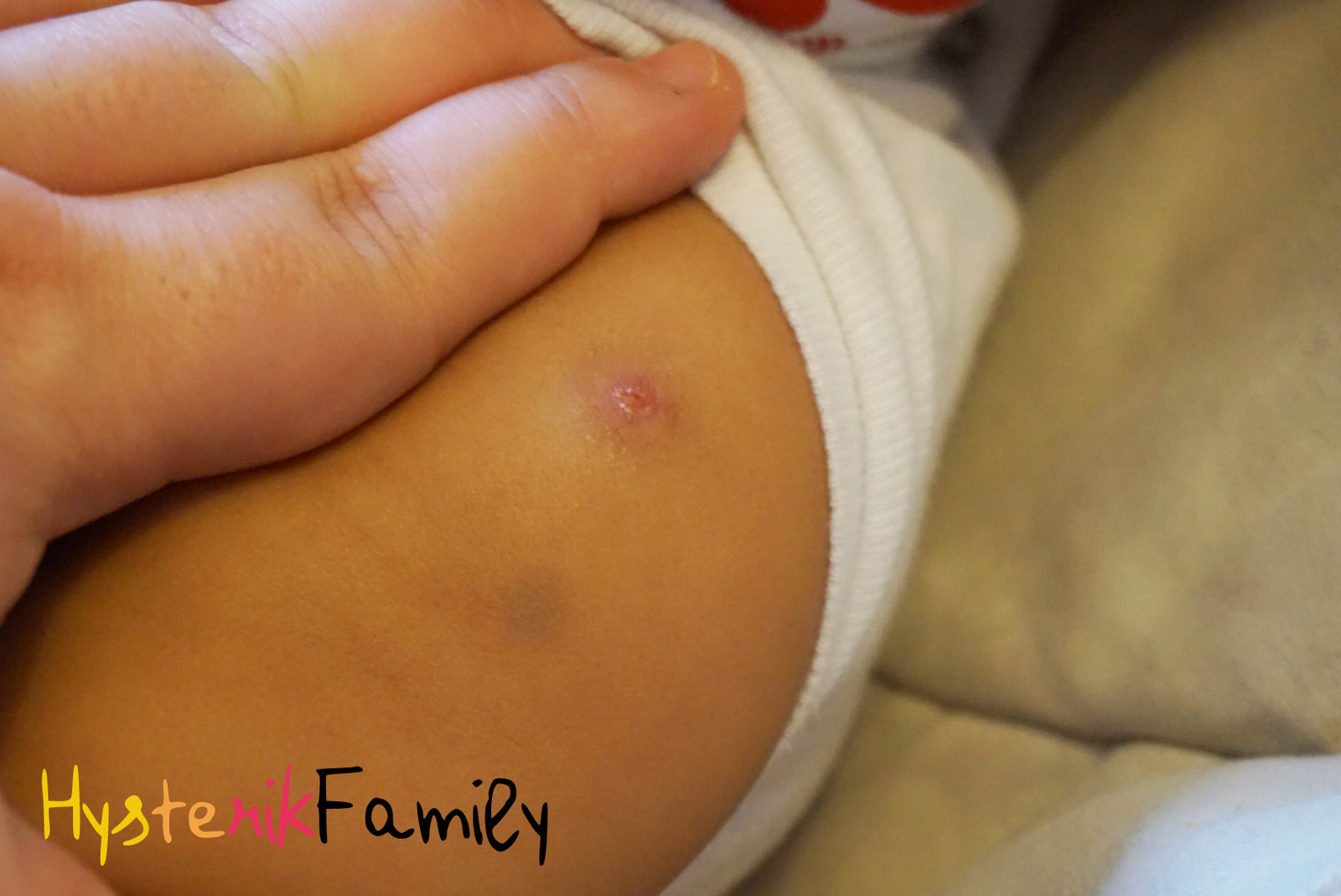 vaccin bcg comment ca se passe