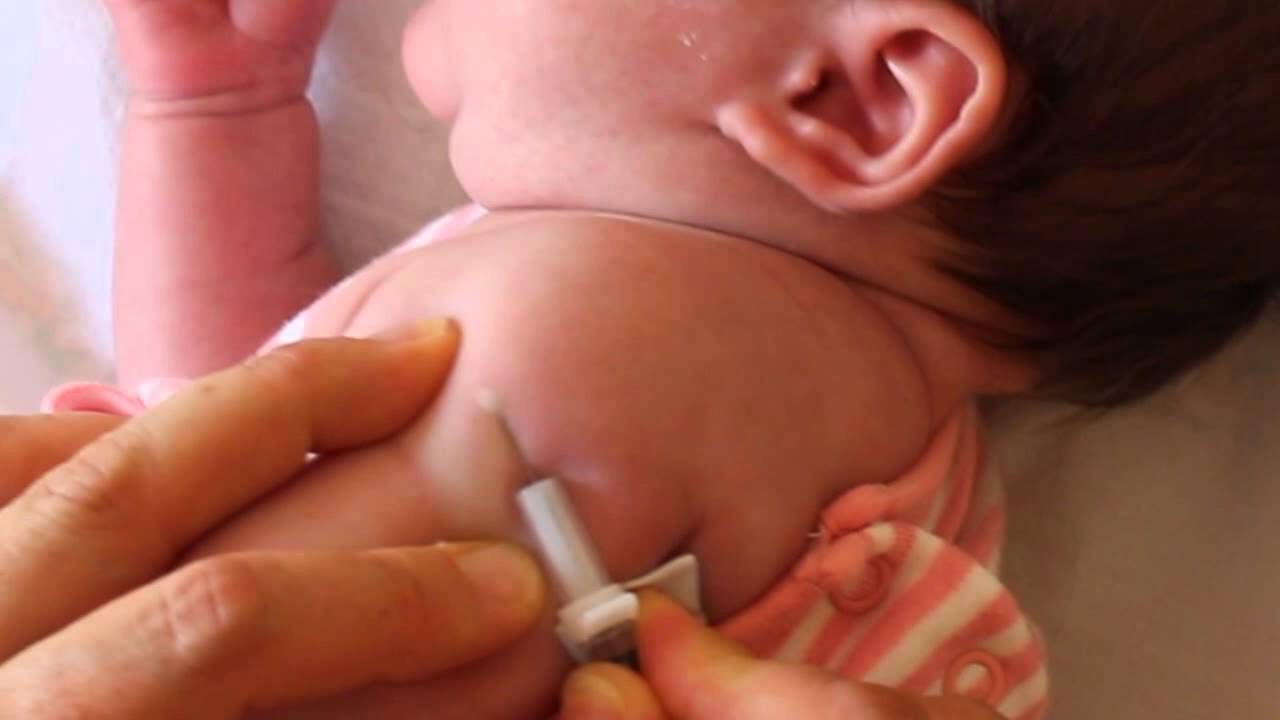 vaccin bcg comment ca se passe