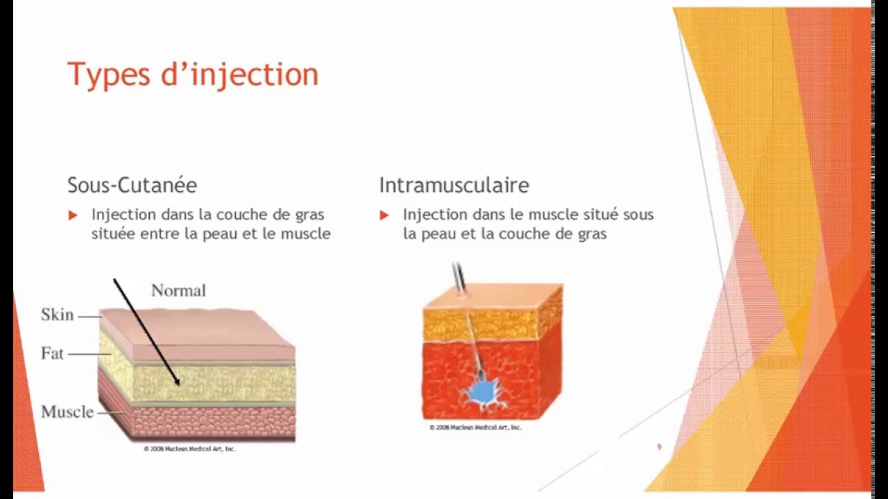 vaccin grippe sous cutane ou intramusculaire