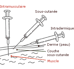 vaccin grippe sous cutane ou intramusculaire